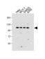GAA Antibody (N-term)