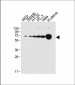 NOX1 Antibody (Center)