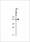 CTSA Antibody (N-term)