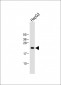 ID1 Antibody (Center)