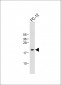 ID1 Antibody (Center)