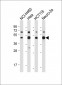 SLC16A3 Antibody (C-term)
