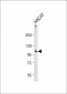 RHBDF2 Antibody (N-term)