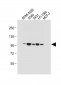 RHBDF2 Antibody (N-term)