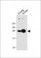 GSTM4 Antibody (N-term)