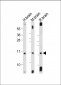 MAP1LC3A antibody(N-term)