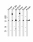 INA (alpha internexin) Antibody (Center)