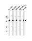 INA (alpha internexin) Antibody (Center)