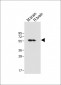 CAMK2D (CAMK2 delta) Antibody (C-term)