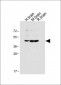 DUSP6 Antibody (Center)