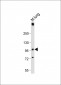 PLD2 Antibody (N-term)