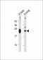 GSTM4 Antibody (N-term)