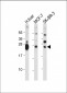 GSTM4 Antibody (N-term)