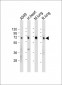 EHD2 Antibody (C-term)