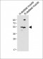 SLC16A3 Antibody (C-term)