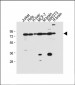 NUR77 (NR4A1) Antibody (S351)