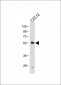 SMAD2 Antibody (T220)