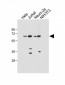 SMAD4 Antibody (T277)