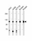 PI3KCA Antibody (Center)