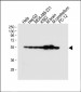 TUBB2B Antibody (N-term)