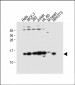 SNRPD3 Antibody (N-term)