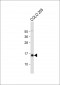 SNRPD3 Antibody (N-term)