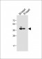 LPAR6 Antibody (Center)