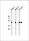 LPAR6 Antibody (Center)