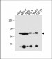 AHR Antibody (Center)