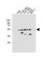 DFNA5 Antibody (N-term)