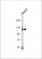 CEACAM Antibody (N-term)