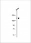 CEACAM Antibody (N-term)