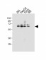 E2F1 Antibody (S337)
