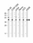 HLA-B Antibody (N-term)