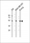 ENT1(Slc29a1) Antibody (S254)
