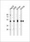 ALDH2 Antibody (Center)