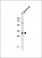 LIN28B Antibody (Center)