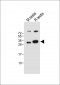 LIN28B Antibody (Center)