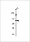 RB1 Antibody (Center S249)