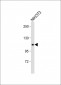 RB1 Antibody (Center S249)