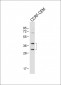 Mouse Nkx2-5 Antibody (Center)