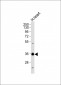 Mouse Nkx2-5 Antibody (Center)