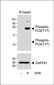 Phospho-PLB(T17) Antibody