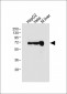ALB Antibody (C-term)