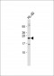 CDKN3 Antibody (C-term)