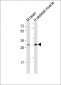 DIO2 Antibody (Center)