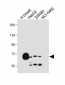 SLCO1B1 Antibody (Center)