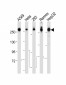 FASN Antibody (Center)