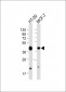 EPCAM Antibody