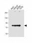 ALOXE3 Antibody (Center)